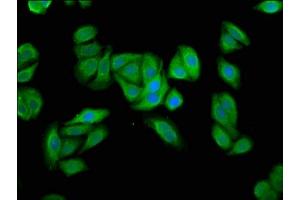 Immunofluorescence staining of HepG2 cells with ABIN7174220 at 1:66, counter-stained with DAPI. (UBIAD1 antibody  (AA 1-82))