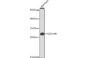 Western blot analysis of extracts of Rat brain, using Calbindin antibody (ABIN7266004) at 1:1000 dilution. (CALB1 antibody  (AA 1-261))
