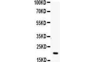 Western blot analysis of APRT using anti-APRT antibody . (APRT antibody  (N-Term))