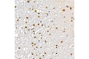 Immunohistochemistry of paraffin-embedded rat kidney using TES Rabbit pAb (ABIN7270772) at dilution of 1:200 (40x lens). (TES antibody  (AA 1-260))