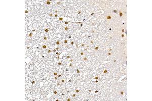Immunohistochemistry of paraffin-embedded rat kidney using TES Rabbit pAb (ABIN7270772) at dilution of 1:200 (40x lens). (TES antibody  (AA 1-260))