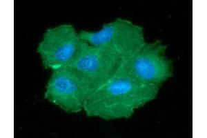 ICC/IF analysis of PGAM2 in Hep3B cells line, stained with DAPI (Blue) for nucleus staining and monoclonal anti-human PGAM2 antibody (1:100) with goat anti-mouse IgG-Alexa fluor 488 conjugate (Green). (PGAM2 antibody)
