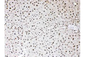 Immunohistochemistry (IHC) image for anti-High Mobility Group Box 1 (HMGB1) (AA 124-154), (C-Term) antibody (ABIN5518759)