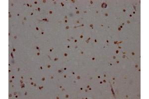 IHC image of ABIN7127324 diluted at 1:100 and staining in paraffin-embedded human brain tissue performed on a Leica BondTM system. (Recombinant ADAR antibody)