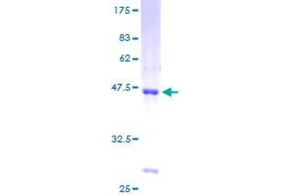 SSBP1 Protein (AA 1-148) (GST tag)