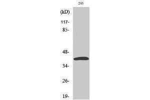 Western Blotting (WB) image for anti-Mitogen-Activated Protein Kinase Kinase 4 (MAP2K4) (Tyr104) antibody (ABIN3175977) (MAP2K4 antibody  (Tyr104))