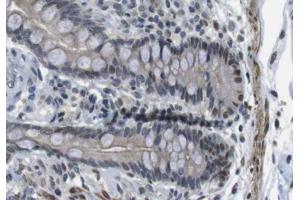 ABIN6266680 at 1/100 staining human colon tissue sections by IHC-P.