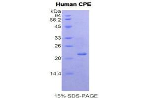 SDS-PAGE (SDS) image for Carboxypeptidase E (CPE) (AA 318-476) protein (His tag) (ABIN1877302) (CPE Protein (AA 318-476) (His tag))