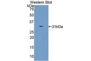 Western blot analysis of recombinant Human COL4a5.