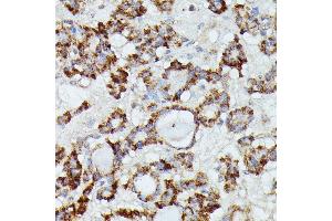 Immunohistochemistry (IHC) image for anti-Mannosidase, beta A, Lysosomal (MANBA) (AA 18-300) antibody (ABIN7268392)