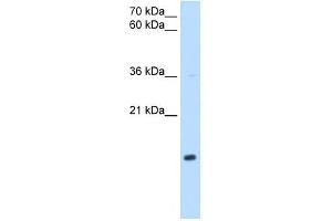 NDUFB5 antibody used at 1 ug/ml to detect target protein.