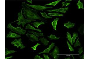 Immunofluorescence of monoclonal antibody to PIP4K2A on HeLa cell. (PIP4K2A antibody  (AA 1-406))