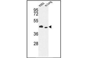 Image no. 1 for anti-Inositol-Trisphosphate 3-Kinase A (ITPKA) (AA 353-382), (C-Term) antibody (ABIN360691) (ITPKA antibody  (C-Term))