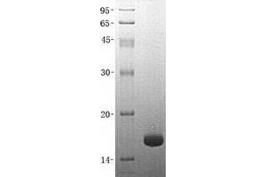 Validation with Western Blot (FABP5 Protein (GST tag))