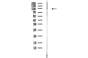 Western blot analysis of lysates from HepG2 cells(LPS, 4h treatment), using TRPV1 Antibody at 1/1000 dilution.