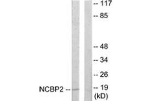 Western blot analysis of extracts from COLO205 cells, using NCBP2 Antibody.