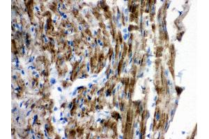 Anti-VDAC Picoband antibody, IHC(P) IHC(P): Rat Cardiac Muscle Tissue (VDAC1 antibody  (Middle Region))
