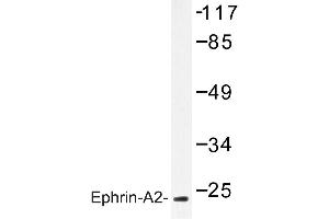 Image no. 1 for anti-Ephrin A2 (EFNA2) antibody (ABIN272138)