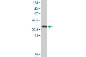 Western Blot detection against Immunogen (36. (SULT1B1 antibody  (AA 1-99))