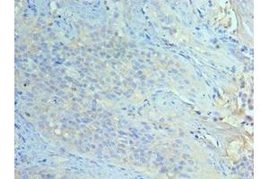 Immunohistochemistry of paraffin-embedded human tonsil tissue using ABIN7151465 at dilution of 1:100 (GCN2 antibody  (AA 1-300))