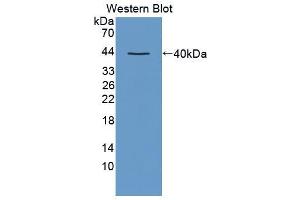 Western blot analysis of the recombinant protein. (CCL3 antibody  (AA 27-92))