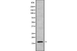 Western blot analysis of VPREB1 using MCF7 whole cell lysates (VPREB1 antibody  (Internal Region))