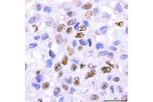 IHC analysis of CRTC3 using anti-CRTC3 antibody (ABIN7599779). (CRTC3 antibody  (AA 116-619))