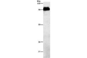 Western Blot analysis of Mouse brain tissue using beta Amyloid Polyclonal Antibody at dilution of 1:1000 (beta Amyloid antibody)