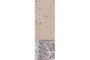 Immunohistochemical staining (Formalin-fixed paraffin-embedded sections) of human cerebral cortex (A, B), human small intestine (C) with MARS polyclonal antibody . (Mars (MARS) antibody)