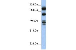 STRBP antibody used at 1 ug/ml to detect target protein. (STRBP antibody  (Middle Region))