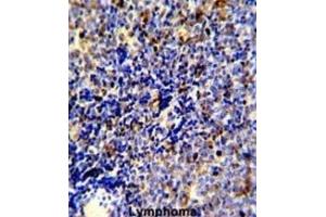 Immunohistochemistry (IHC) image for anti-C-Mer Proto-Oncogene Tyrosine Kinase (MERTK) antibody (ABIN3003537)