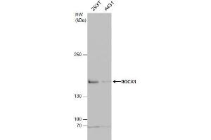 WB Image ROCK1 antibody [N1N2], N-term detects ROCK1 protein by western blot analysis.