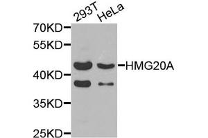 Western blot analysis of extracts of 293T and HeLa cells, using HMG20A antibody. (HMG20A antibody)
