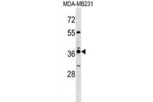 Western Blotting (WB) image for anti-Vomeronasal 1 Receptor 4 (VN1R4) antibody (ABIN3000072) (VN1R4 antibody)