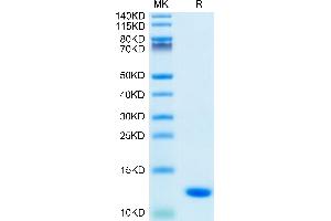 S100A8 Protein (AA 1-93) (His tag)