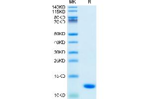 Human S100A8 on Tris-Bis PAGE under reduced condition. (S100A8 Protein (AA 1-93) (His tag))