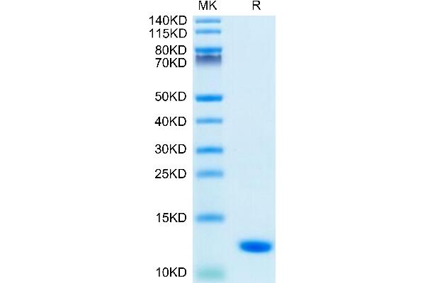 S100A8 Protein (AA 1-93) (His tag)