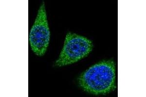 Confocal immunofluorescent analysis of MMP7 antibody with 293 cells followed by Alexa Fluor 488-conjugated goat rabbit lgG (green). (MMP7 antibody  (AA 117-146))