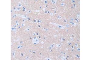 IHC-P analysis of Kidney tissue, with DAB staining. (PPH-3 antibody  (Regulatory Subunit 1))