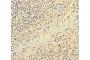 Immunohistochemistry of paraffin-embedded human tonsil tissue using ABIN7151727 at dilution of 1:100