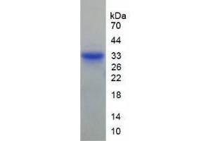 SDS-PAGE analysis of Human Matrix Metalloproteinase 7 (MMP7) Protein. (MMP7 Protein)