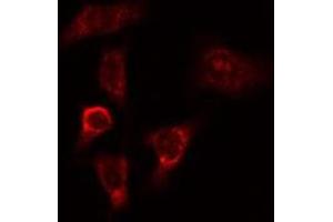 ABIN6275266 staining HeLa cells by IF/ICC. (MYO9B antibody  (N-Term))