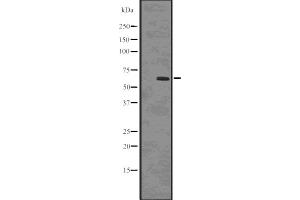 Western blot analysis of Phospho-SQSTM1/p62 (Ser403) using HepG2 whole cell lysates (SQSTM1 antibody  (pSer403))