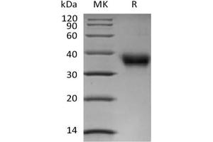 Western Blotting (WB) image for Folate Receptor 1 (Adult) (FOLR1) protein (Biotin,His-Avi Tag) (ABIN7319830)