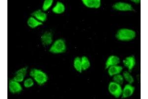 Detection of AST in Hela cells using Polyclonal Antibody to Aspartate Aminotransferase (AST) (GOT1 antibody  (AA 1-413))