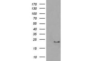 Image no. 1 for anti-HRas proto-oncogene, GTPase (HRAS) antibody (ABIN1498713)