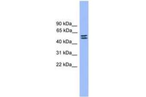 Image no. 1 for anti-serine Peptidase Inhibitor, Kunitz Type 1 (SPINT1) (AA 421-470) antibody (ABIN6745334)