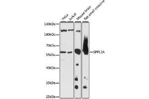 Western blot analysis of extracts of various cell lines, using SPPL2A antibody (ABIN7270297) at 1:1000 dilution. (SPPL2A antibody  (AA 421-520))