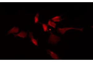 ABIN6267701 staining NIH-3T3 by IF/ICC. (CaMK2 alpha/beta/delta antibody  (pThr305))