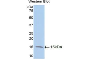 Detection of Recombinant TFF2, Human using Polyclonal Antibody to Trefoil Factor 2 (TFF2) (Trefoil Factor 2 antibody  (AA 27-128))